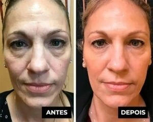 LuteinaRoll 5 em 1 - Remove Olheiras, Manchas e Revitaliza a Pele ao Redor dos Olhos