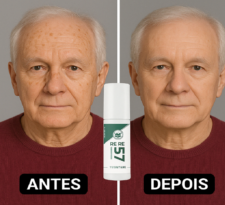 Spray- 577 Remove manchas de SOL, IDADE E MELASMA! ULTIMAS UNIDADES - 60% DE DESCONTO + FRETE GRÁTIS!