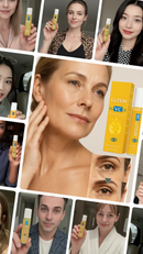 LuteinaRoll 5 em 1 - Remove Olheiras, Manchas e Revitaliza a Pele ao Redor dos Olhos